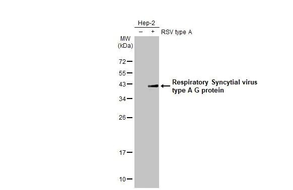 RSV Type A Glycoprotein G Antibody in Western Blot (WB)