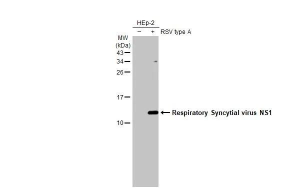 RSV NS1 Antibody in Western Blot (WB)