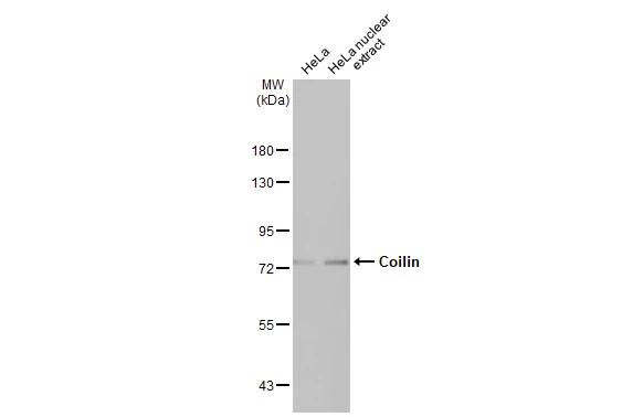 Coilin Antibody in Western Blot (WB)
