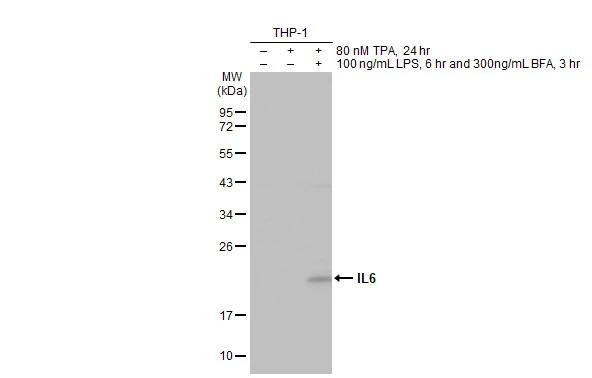 IL-6 Antibody in Western Blot (WB)
