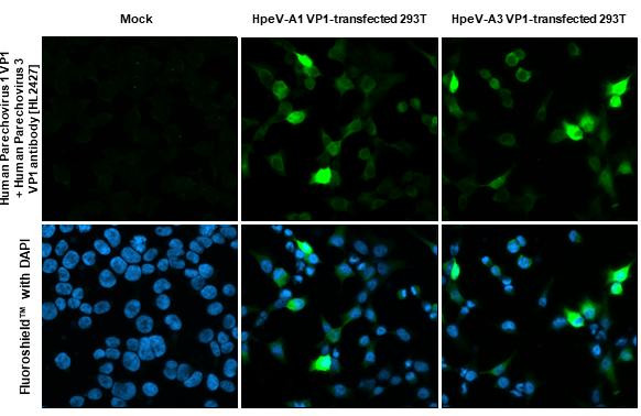 Human Parechovirus Type 1/3 VP1 Antibody in Immunocytochemistry (ICC/IF)