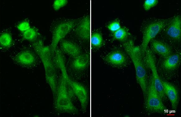 IFIT3 Antibody in Immunocytochemistry (ICC/IF)