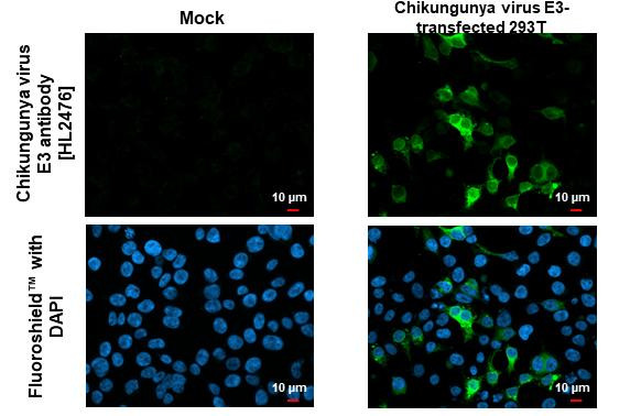Chikungunya Virus E3 Antibody in Immunocytochemistry (ICC/IF)