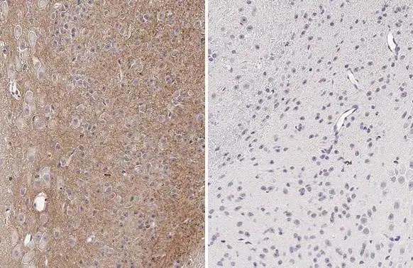 Phospho-Tau (Thr181) Antibody in Immunohistochemistry (Paraffin) (IHC (P))