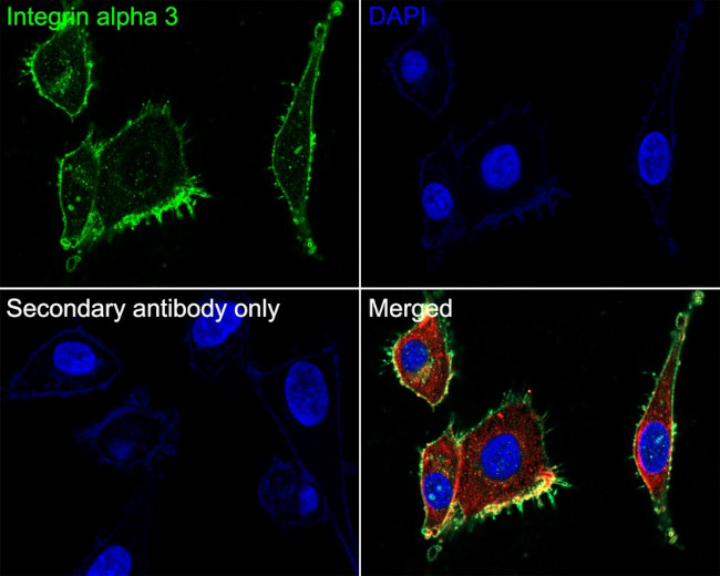CD49c (Integrin alpha 3) Antibody in Immunocytochemistry (ICC/IF)