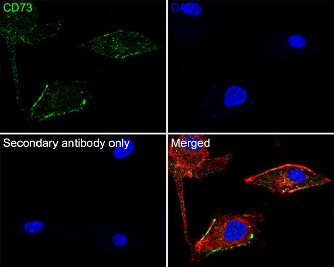 CD73 Antibody in Immunocytochemistry (ICC/IF)