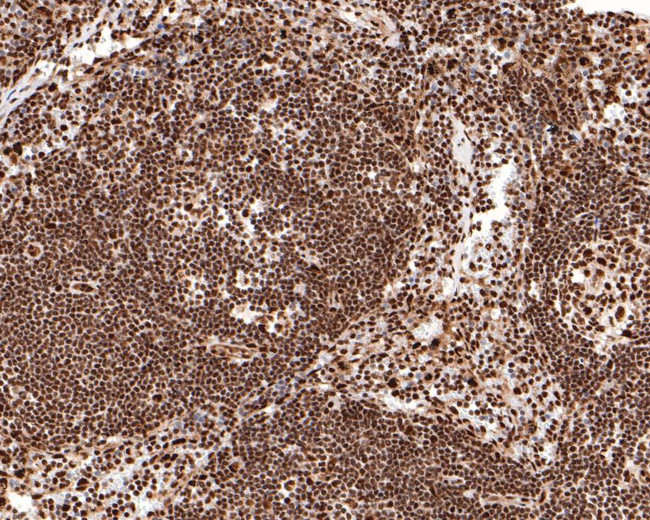 BRCA1 Antibody in Immunohistochemistry (Paraffin) (IHC (P))