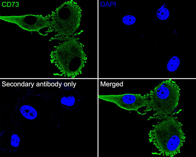 CD73 Antibody in Immunocytochemistry (ICC/IF)