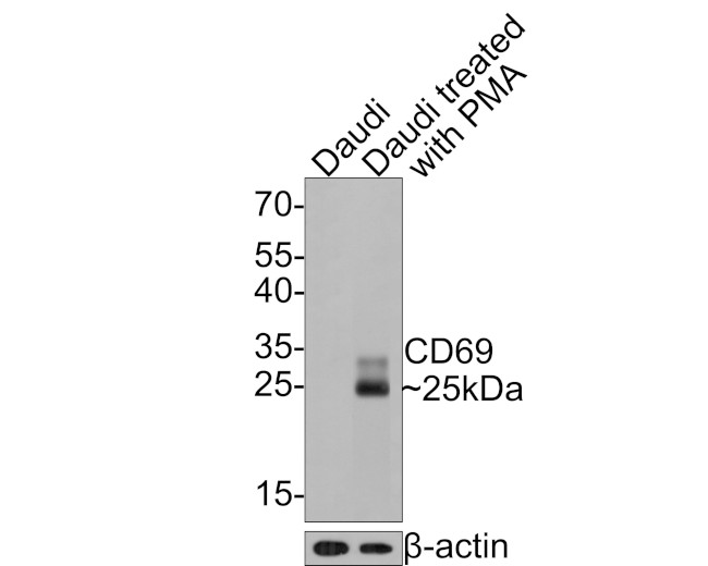 CD69 Antibody in Western Blot (WB)