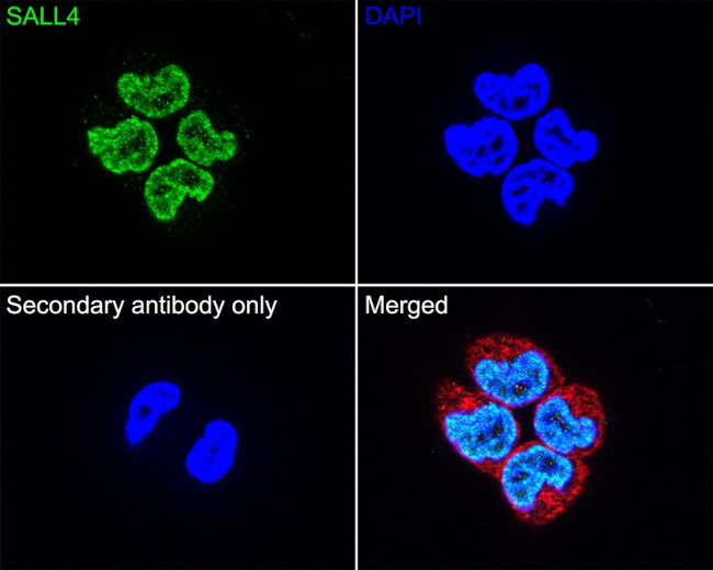 SALL4 Antibody in Immunocytochemistry (ICC/IF)