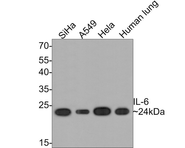 IL-6 Antibody in Western Blot (WB)