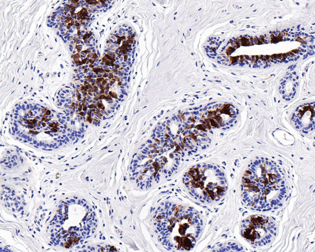 Mammaglobin A Antibody in Immunohistochemistry (Paraffin) (IHC (P))