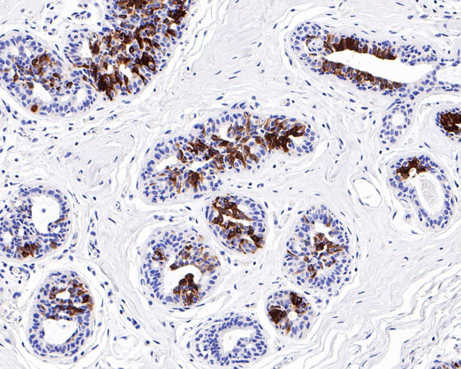 Mammaglobin A Antibody in Immunohistochemistry (Paraffin) (IHC (P))