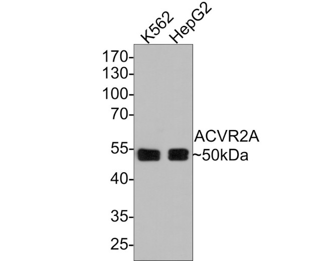 ACVR2A Antibody in Western Blot (WB)