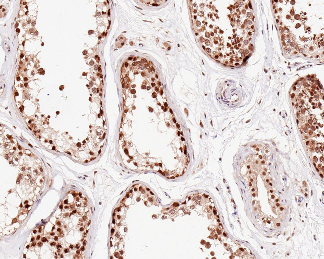 PSMD6 Antibody in Immunohistochemistry (Paraffin) (IHC (P))