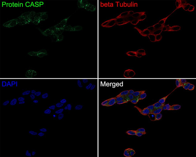CUX1/Protein CASP Antibody in Immunocytochemistry (ICC/IF)
