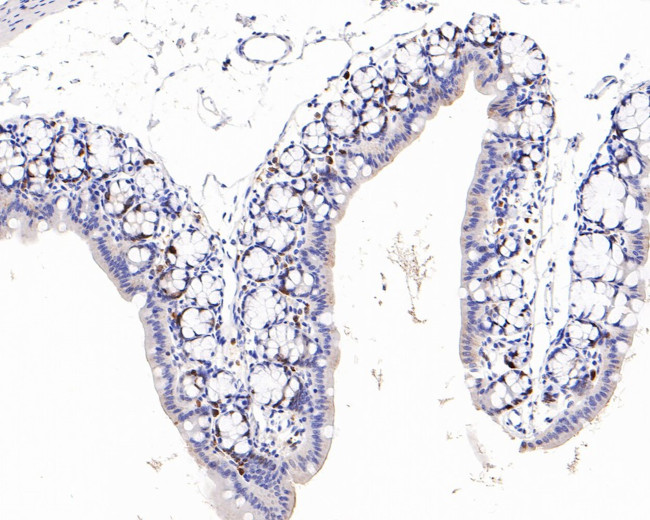 Ki-67 Antibody in Immunohistochemistry (Paraffin) (IHC (P))