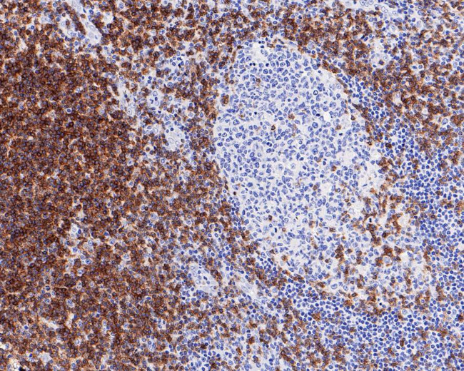 CD3 Antibody in Immunohistochemistry (Paraffin) (IHC (P))
