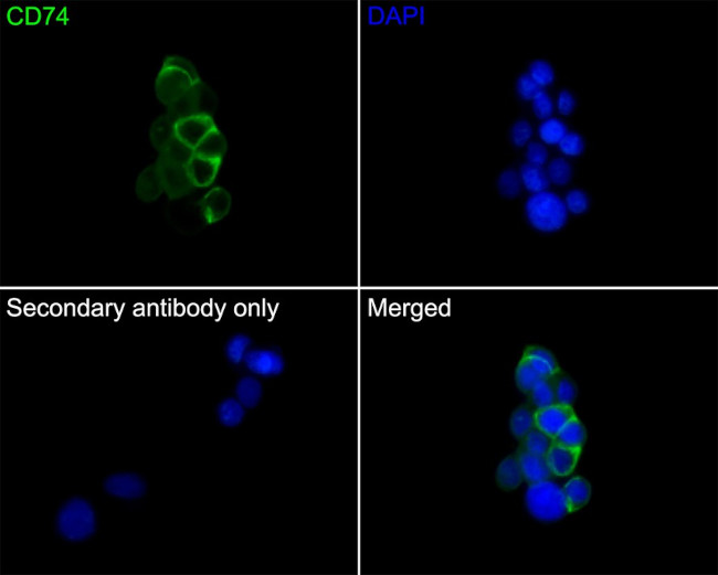 CD74 Antibody in Immunocytochemistry (ICC/IF)