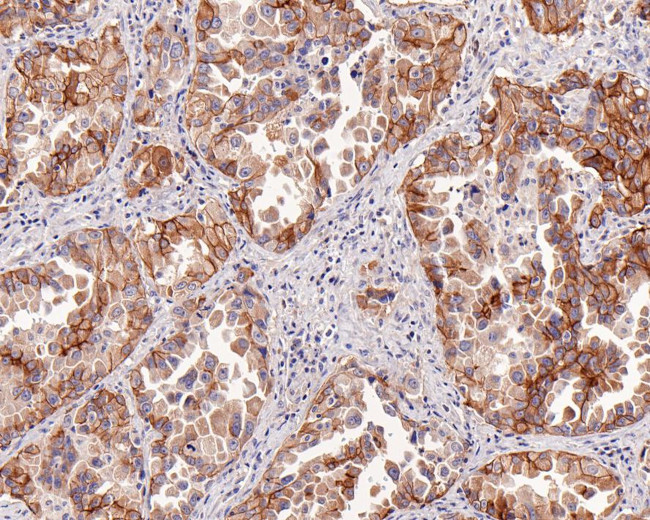 c-Met Antibody in Immunohistochemistry (Paraffin) (IHC (P))