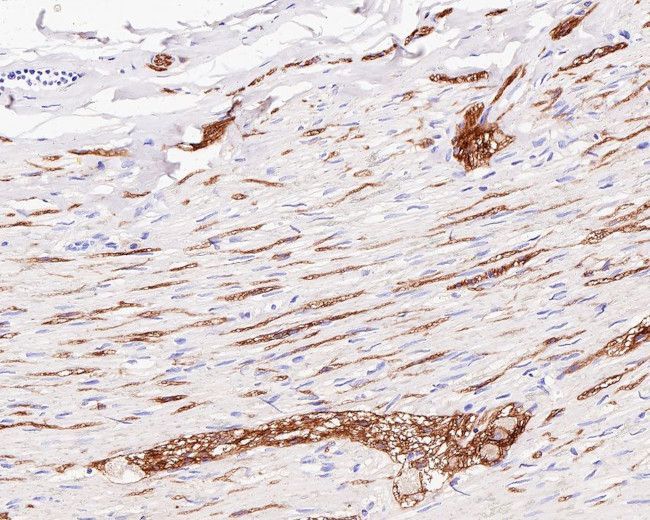 CD56 Antibody in Immunohistochemistry (Paraffin) (IHC (P))