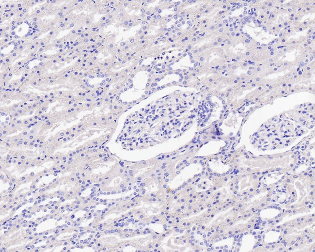 Mammaglobin A Antibody in Immunohistochemistry (Paraffin) (IHC (P))