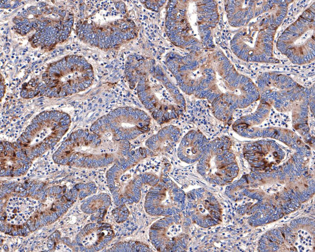 Annexin VII Antibody in Immunohistochemistry (Paraffin) (IHC (P))