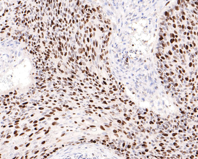 Ki-67 Antibody in Immunohistochemistry (Paraffin) (IHC (P))