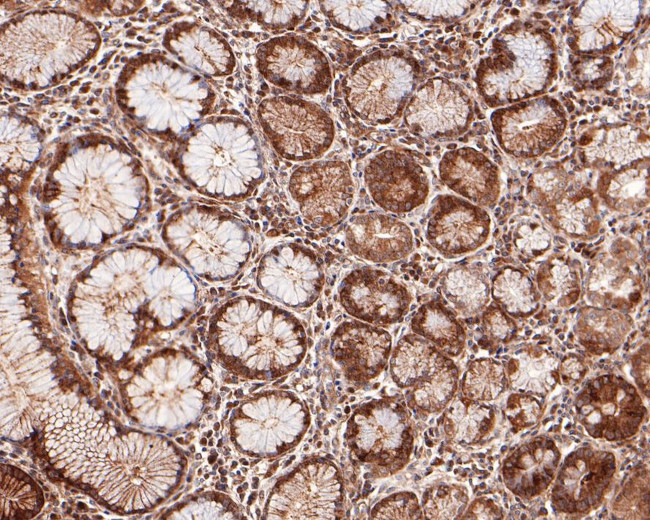 PCPTP1 Antibody in Immunohistochemistry (Paraffin) (IHC (P))