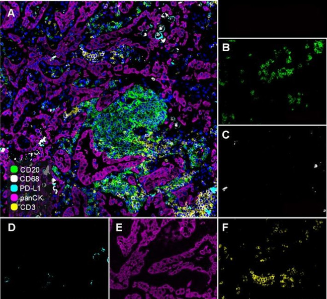 CD20 Antibody in Immunohistochemistry (Paraffin) (IHC (P))