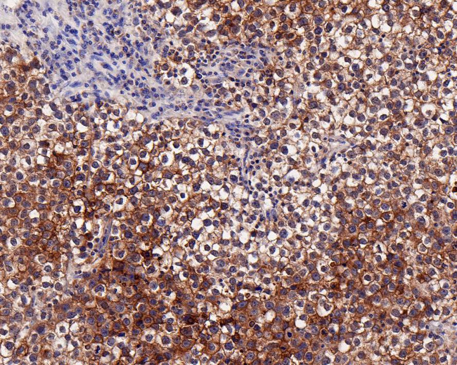 Placental Alkaline Phosphatase Antibody in Immunohistochemistry (Paraffin) (IHC (P))