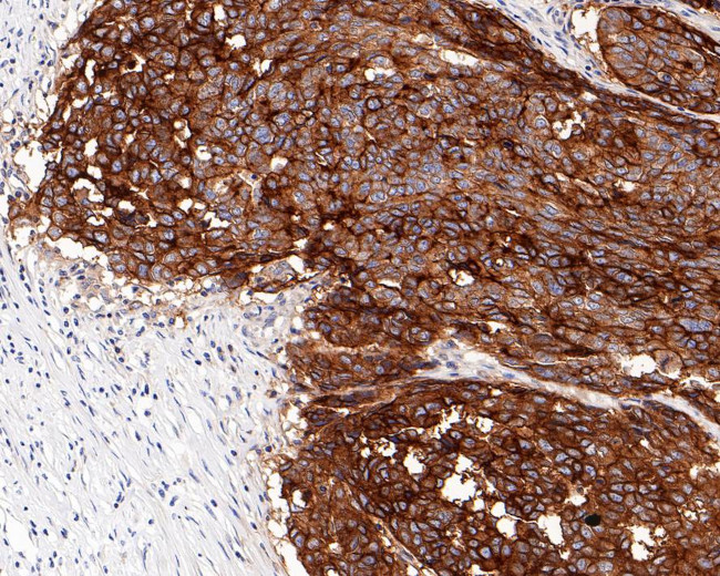 CD47 Antibody in Immunohistochemistry (Paraffin) (IHC (P))