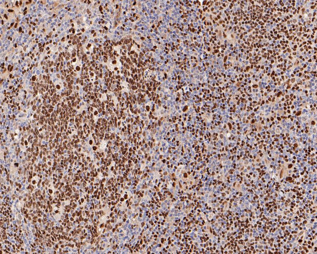 PU.1 Antibody in Immunohistochemistry (Paraffin) (IHC (P))