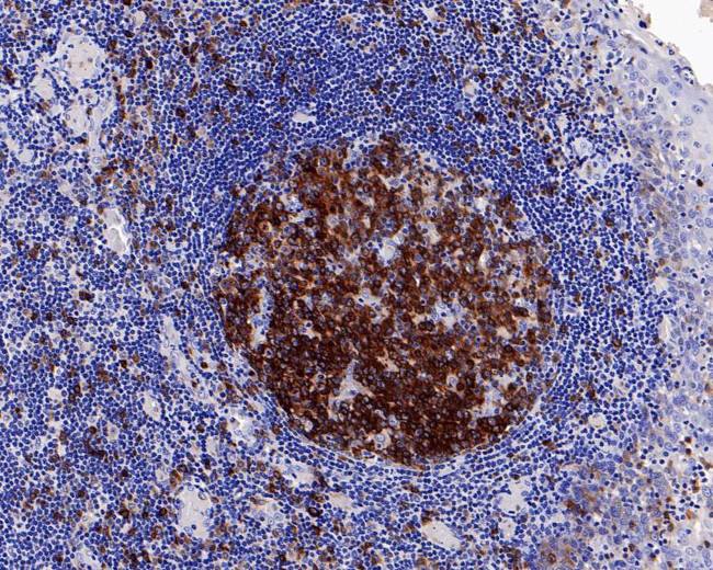 Stathmin 1 Antibody in Immunohistochemistry (Paraffin) (IHC (P))