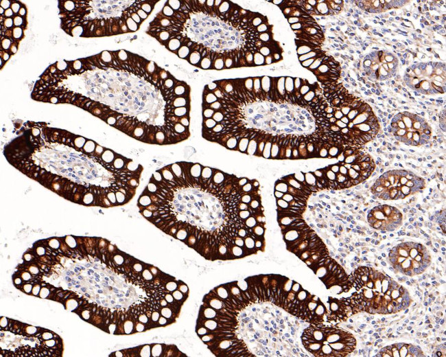ErbB3 Antibody in Immunohistochemistry (Paraffin) (IHC (P))