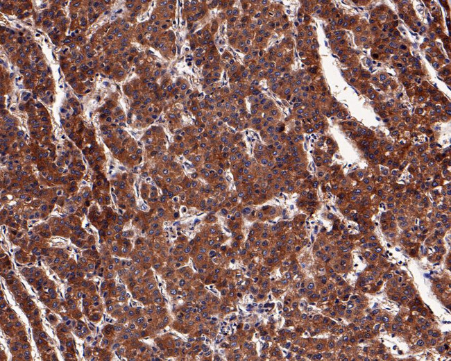 Tensin 4 Antibody in Immunohistochemistry (Paraffin) (IHC (P))