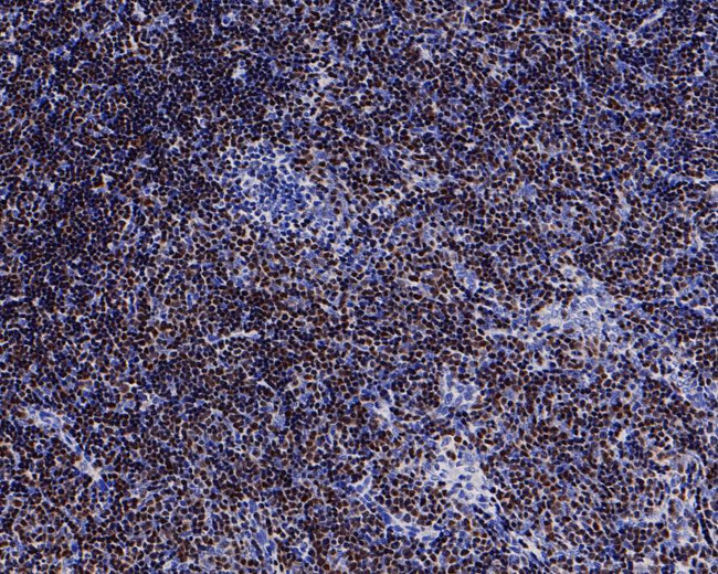 TdT Antibody in Immunohistochemistry (Paraffin) (IHC (P))