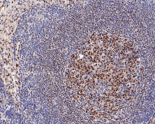 LMO2 Antibody in Immunohistochemistry (Paraffin) (IHC (P))