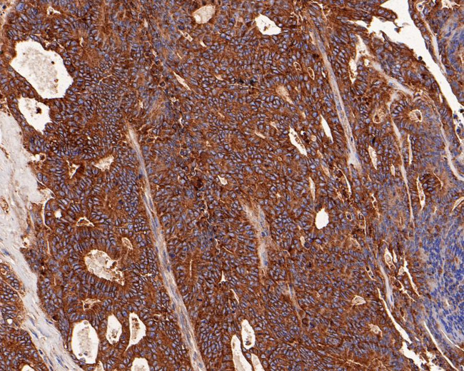 RALA Antibody in Immunohistochemistry (Paraffin) (IHC (P))