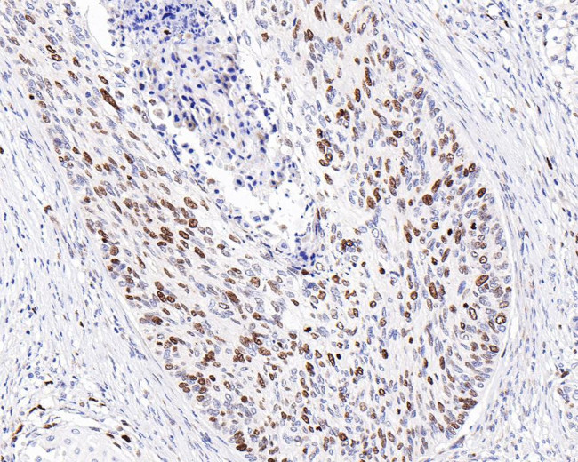 Ki-67 Antibody in Immunohistochemistry (Paraffin) (IHC (P))
