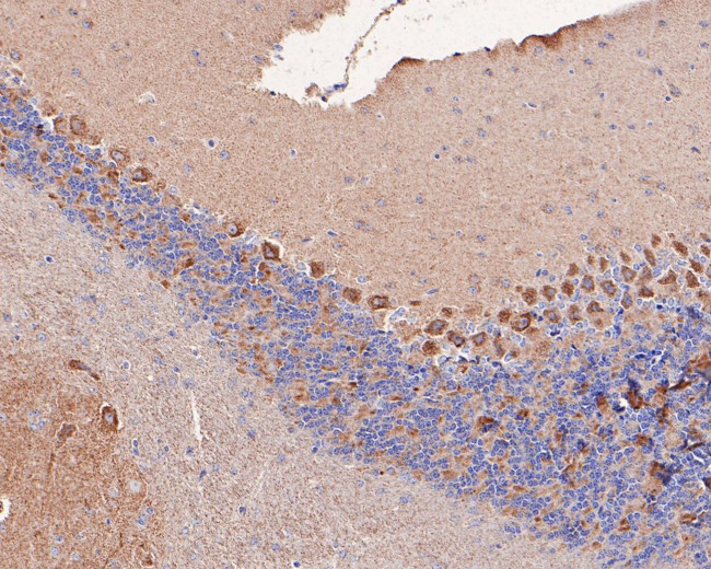 DLAT Antibody in Immunohistochemistry (Paraffin) (IHC (P))