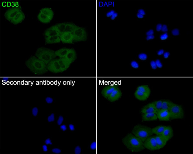 CD38 Antibody in Immunocytochemistry (ICC/IF)