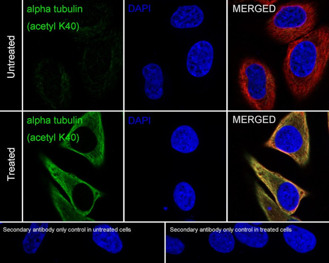 Acetyl-alpha Tubulin (Lys40) Antibody in Immunocytochemistry (ICC/IF)