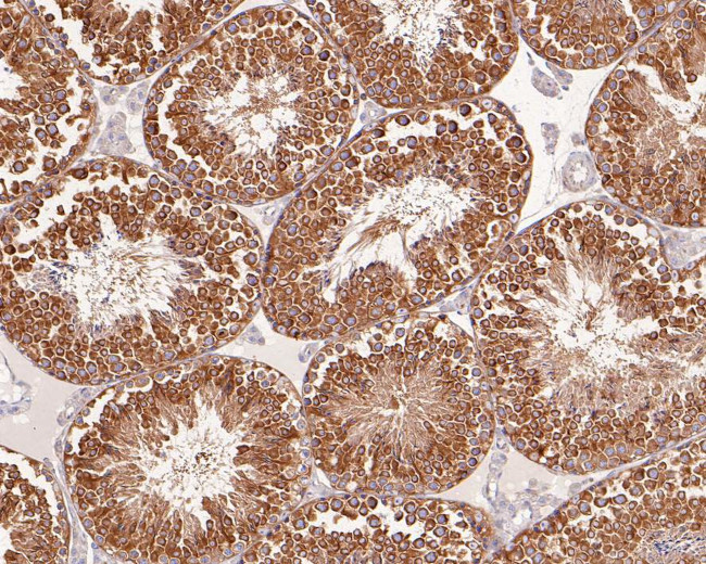 TUBA3C Antibody in Immunohistochemistry (Paraffin) (IHC (P))