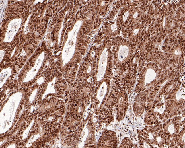 RBBP5 Antibody in Immunohistochemistry (Paraffin) (IHC (P))