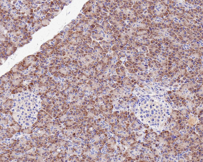 TNF alpha Antibody in Immunohistochemistry (Paraffin) (IHC (P))