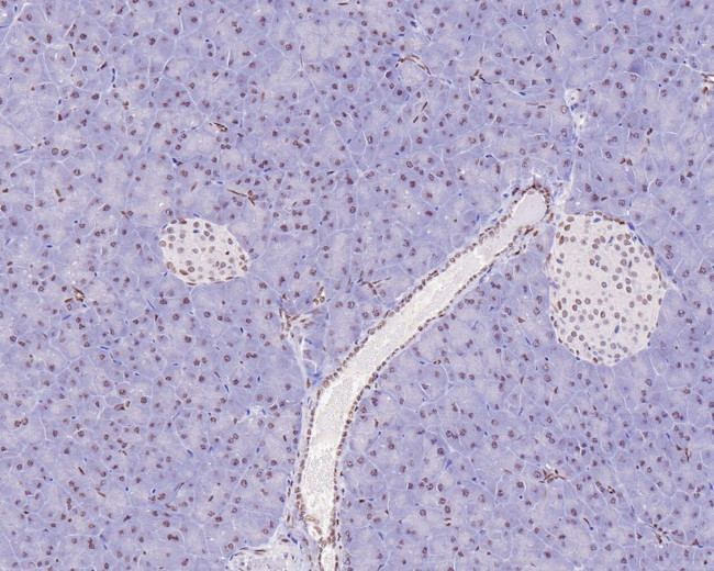 PBX1 Antibody in Immunohistochemistry (Paraffin) (IHC (P))