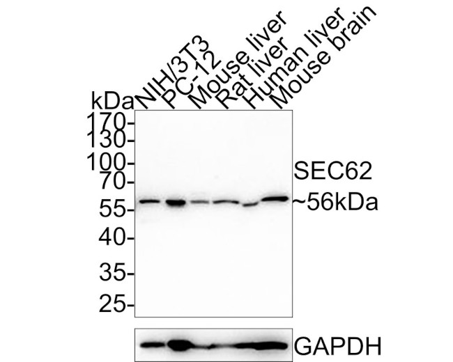 SEC62 Antibody in Western Blot (WB)