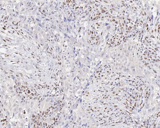 ZEB1 Antibody in Immunohistochemistry (Paraffin) (IHC (P))