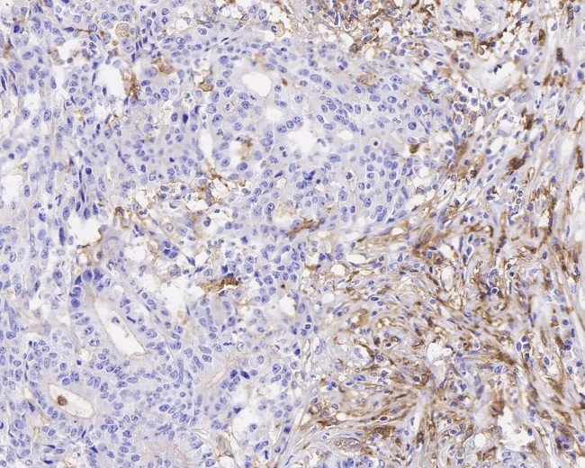 CD14 Antibody in Immunohistochemistry (Paraffin) (IHC (P))